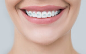 Orthodontics Henfield